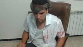 Ksar El Boukhari : un jeune tabassé par les gendarmes